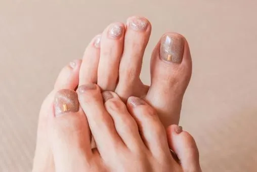 爪が黄色い・厚い…それ肥厚爪かもしれません|夏に増える足爪トラブルとは?/巻き爪補正24栃木フットケアセンター宇都宮店